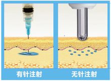 注射器